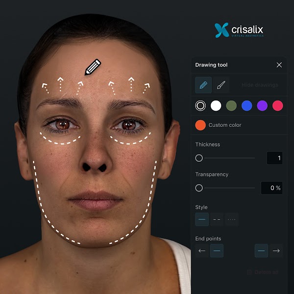 Simulation 3D des visages dans l’application Crisalix avec l’outil « Dessin » ouvert. 1080px x 1080px.
