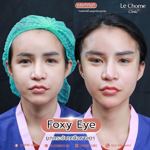 ตา 2 ชั้น