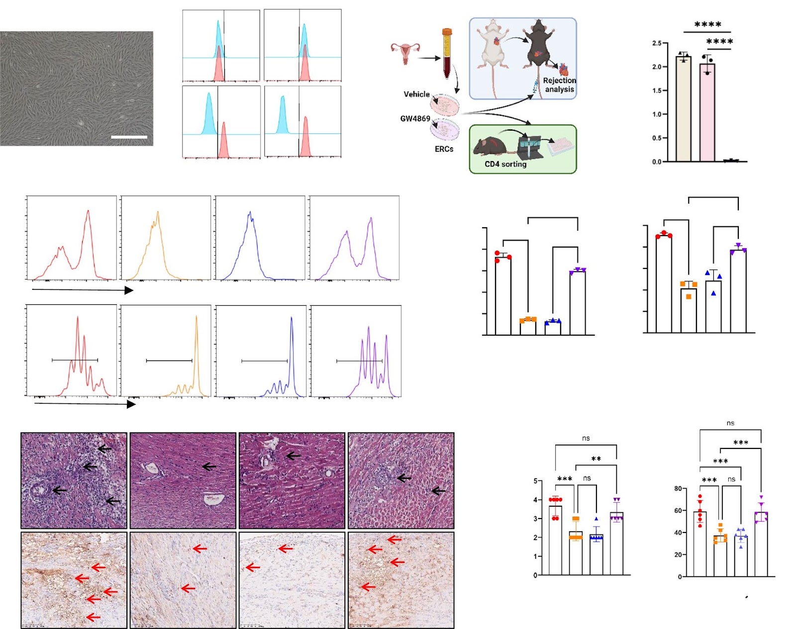 CD73-expressing endometrial regenerative cell-derived exosomes mitigate acute cardiac allograft rejection through regulating adenosine metabolism in mice