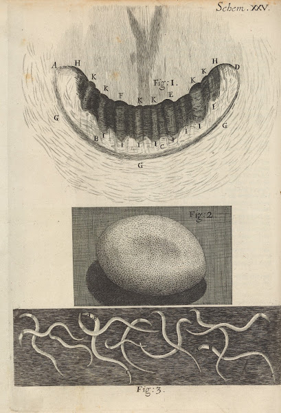 Microscopic view of snail teeth and silkworm egg 1665