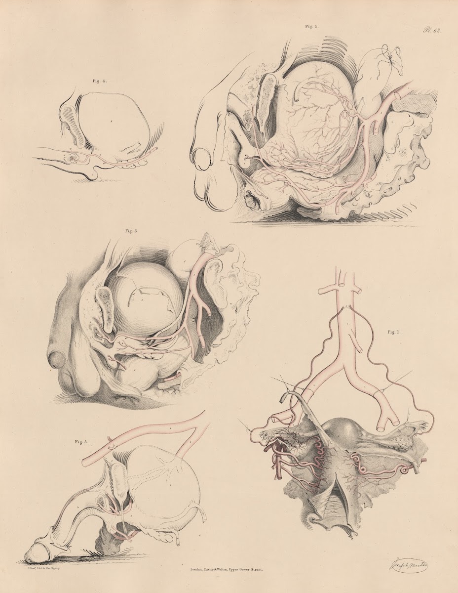 The Uterine and Ovarian branches The Pudic artery and the branches of the Pelvic