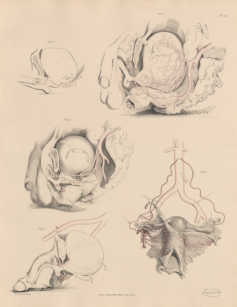 The Uterine and Ovarian branches The Pudic artery and the branches of the Pelvic
