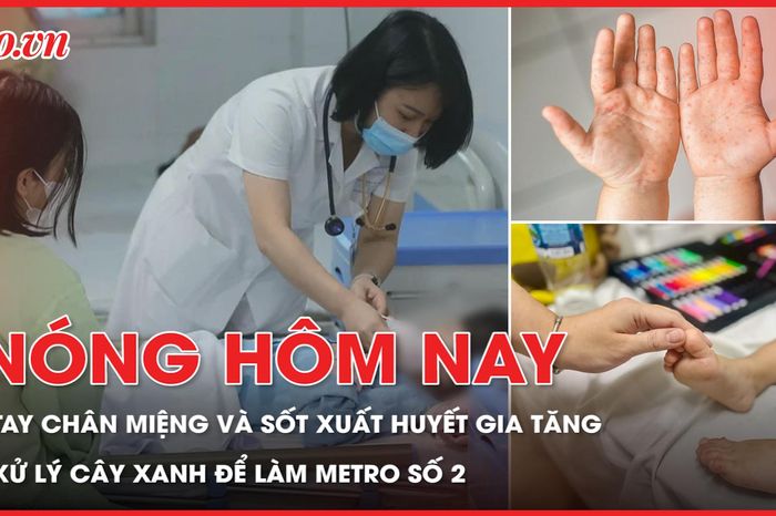 Số ca tay chân miệng và sốt xuất huyết gia tăng; Xử lý hơn 450 cây xanh để làm metro số 2 - Báo Pháp Luật TP.HCM