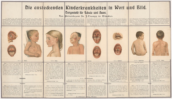 Table of infectious childhood diseases 1928
