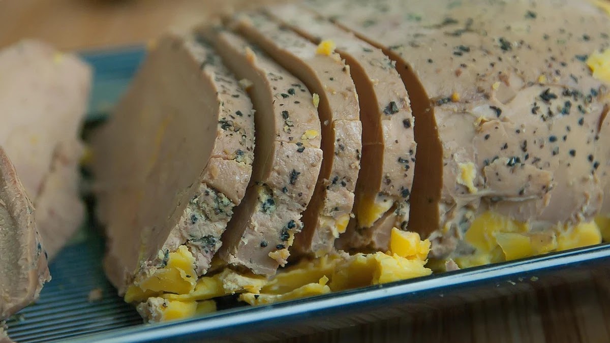 간 지방 축적 구조와 지방간 예방 관리 기준