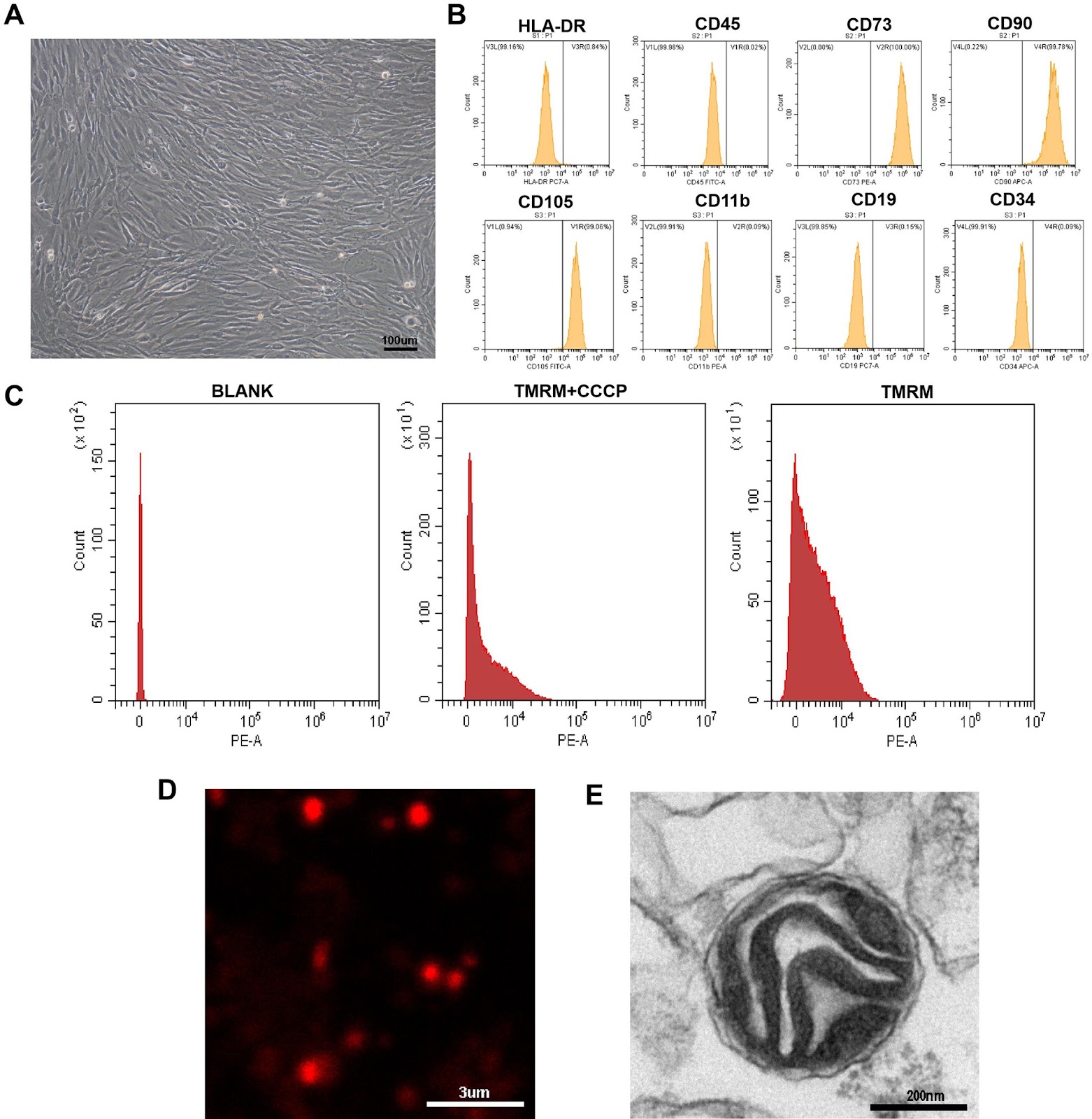 Autologous bone marrow mesenchymal stem cell mitochondrial transplantation in recurrent assisted reproductive technology failure: a randomized controlled trial
