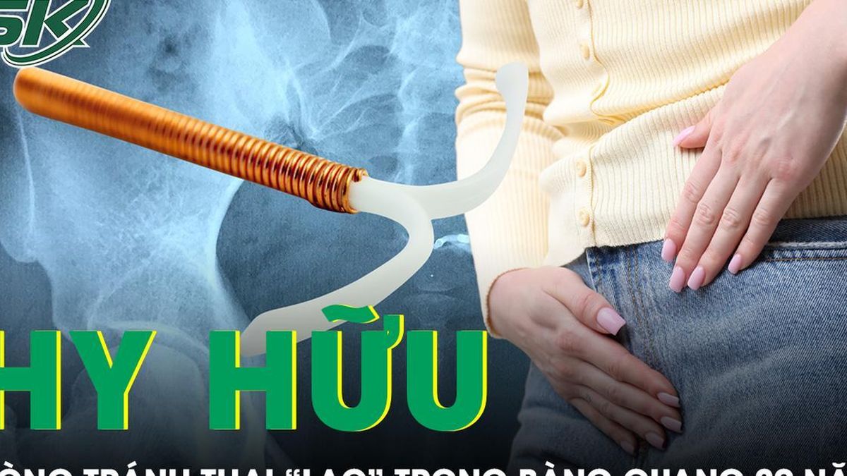 Vòng tránh thai 'mất tích' 29 năm bất ngờ được tìm thấy trong bàng quang - Báo Sức Khỏe &amp; Đời Sống