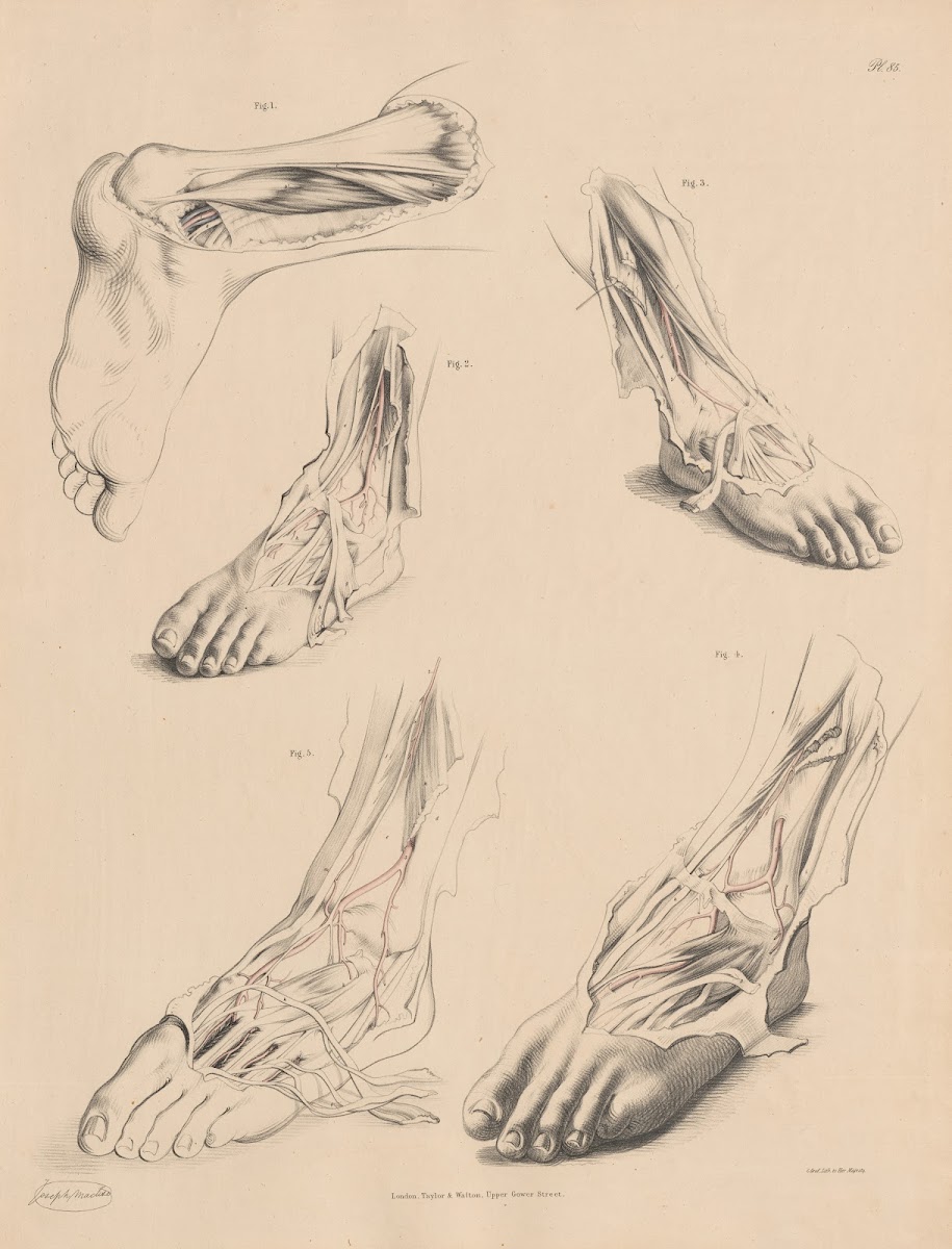 Unusual conformation of the Muscle over the Posterior Tibial 1844