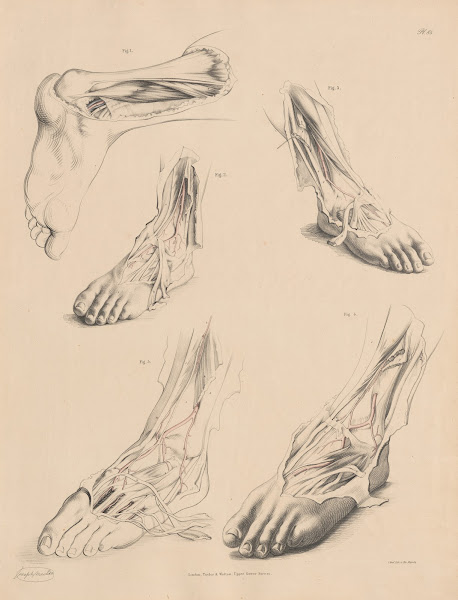 Unusual conformation of the Muscle over the Posterior Tibial 1844