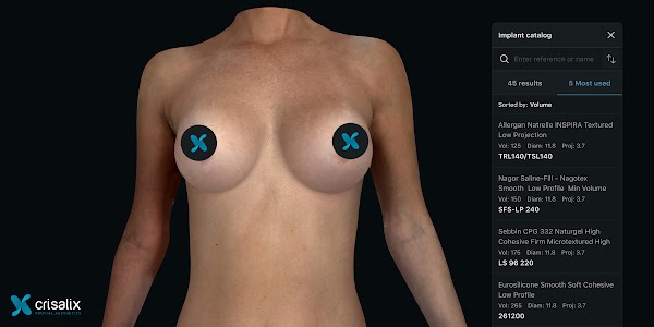 Simulation mammaire 3D dans l’application Crisalix avec le « catalogue d’implants » ouvert. 2400px x 1200px.