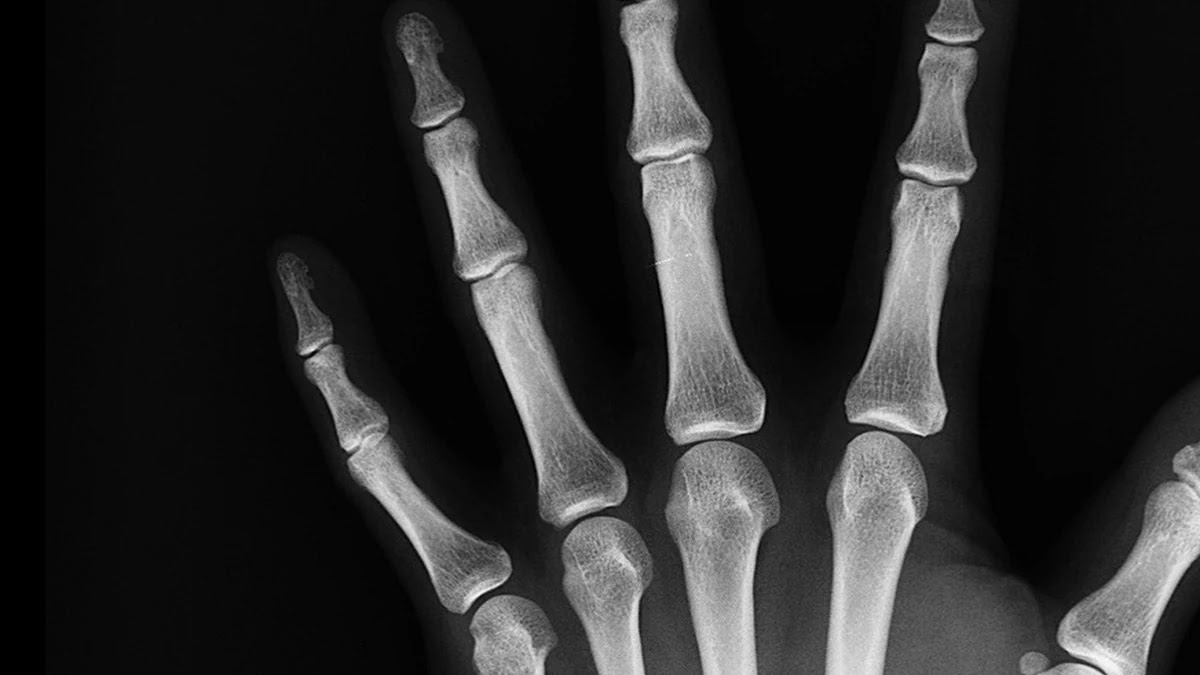 암보험 진단비 vs 수술비 보장, 차이점과 선택 기준