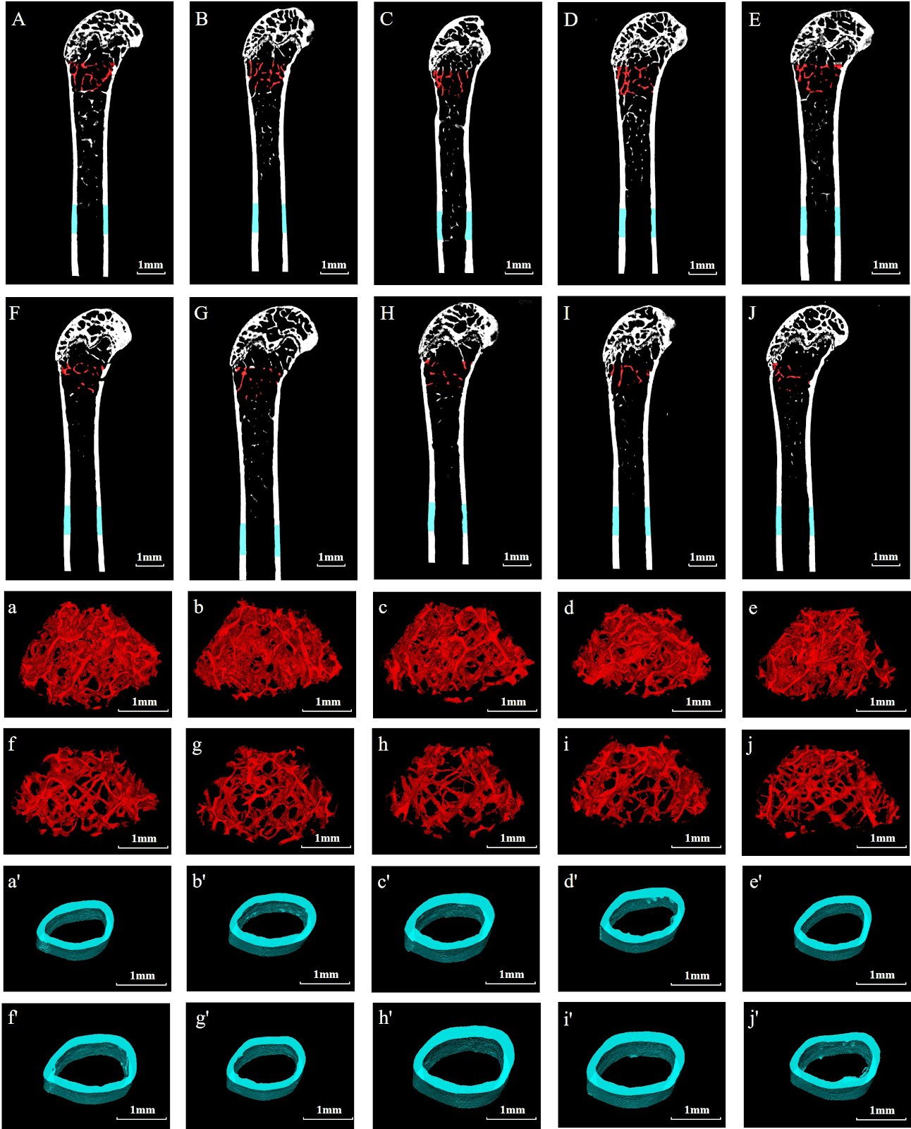 Serum remnant cholesterol reduces bone quality in obese mice