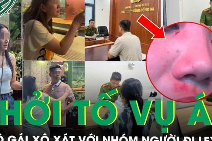 Khởi tố vụ án 2 cô gái xô xát với nhóm người đi Lexus ở Hoàng Cầu, phẫn nộ lời kể của nạn nhân - Báo Sức Khỏe &amp; Đời Sống