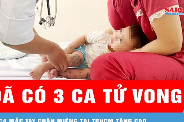 Số ca mắc tay chân miệng tại TPHCM tăng cao, đã có 3 ca tử vong - Báo Sài Gòn Giải Phóng