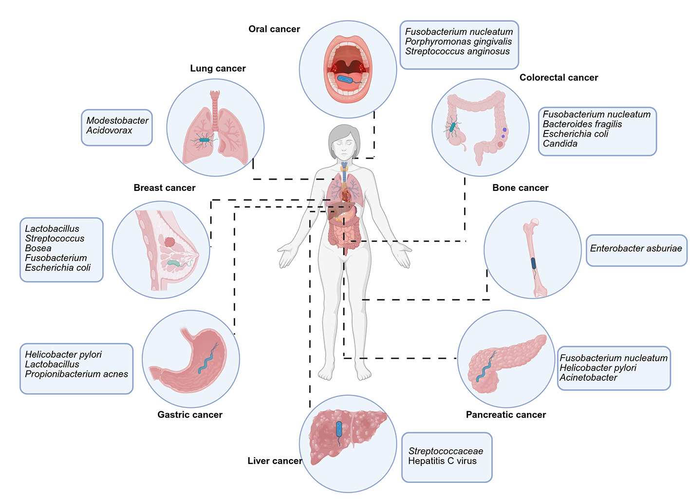 The Intratumoral Microbiota: From Origin and Identification to Function and Therapeutic Perspective