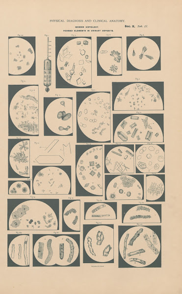 Morphological Elements In Urinary Deposits 1888