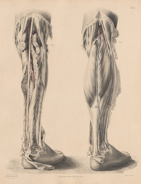Views of the Arteries on the back part of the LegPopliteal Posterior Tibial and