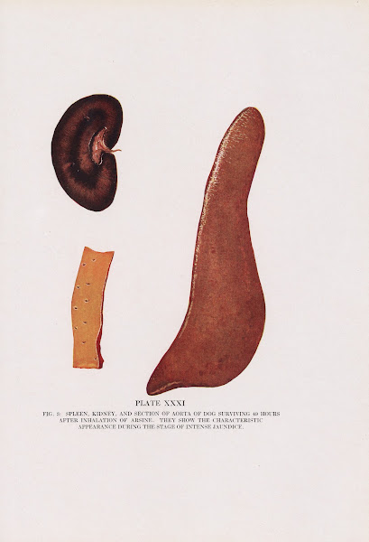 Plate XXXI Fig 3 Spleen kidney and section of aorta of dog surviving 49 hours af