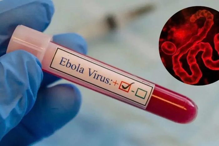 WHO kêu gọi giám sát Ebola toàn cầu - Đài Phát thanh và truyền hình Hà Nội