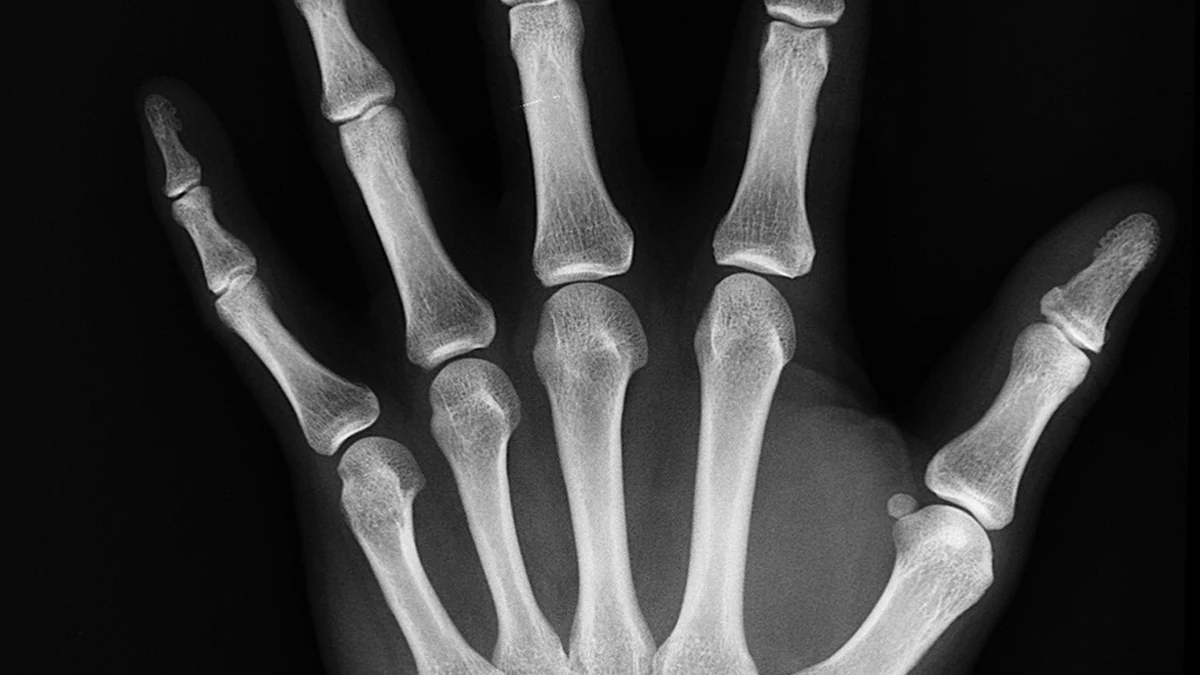 건강보험 환급금 조회 후 돌려받는 절차와 주의사항