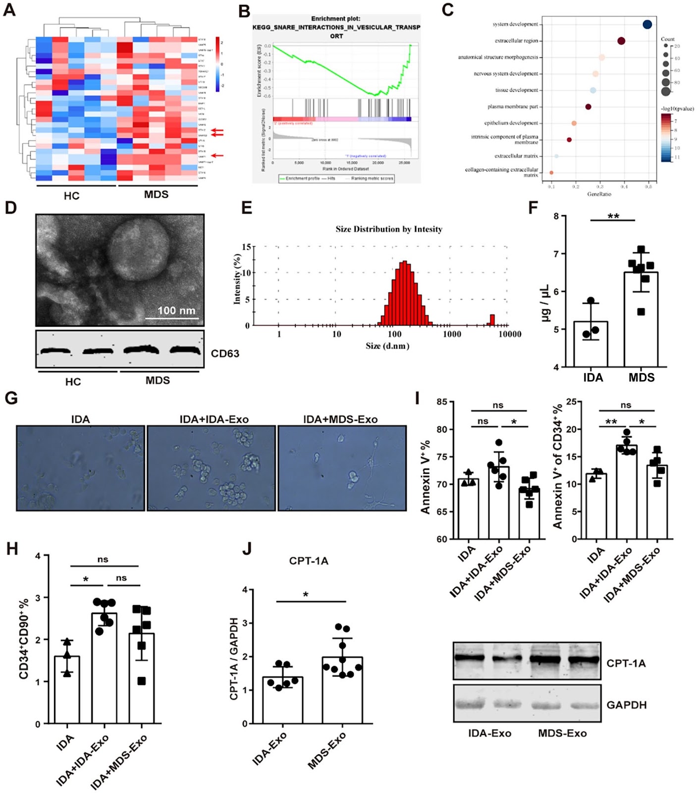 MSCs with upregulated lipid metabolism block hematopoietic stem cell differentiation via exosomal CTP-1A in MDS