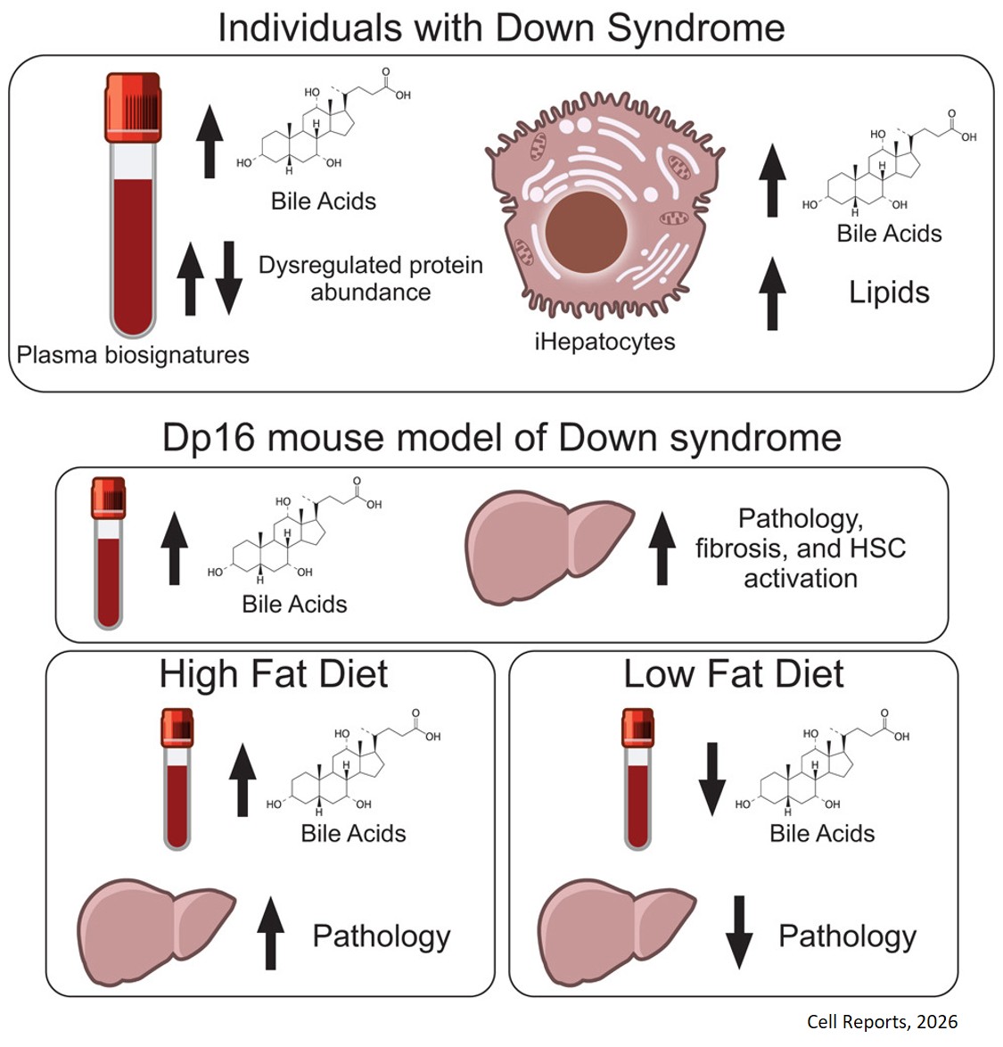 Widespread liver dysfunction in Down syndrome