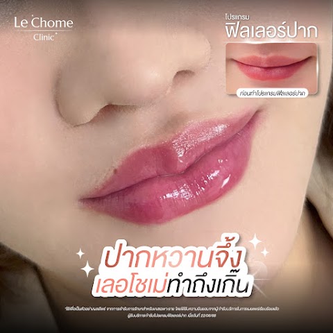 ฟิลเลอร์
