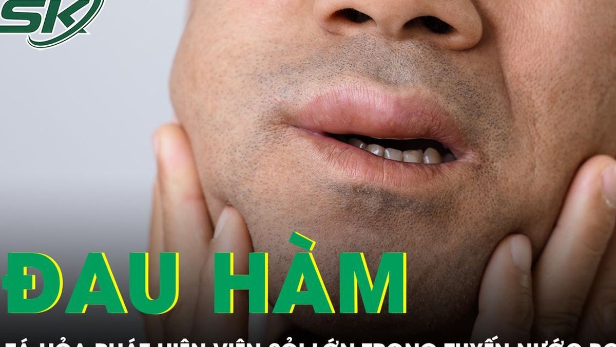 Đau hàm lâu ngày, người đàn ông tá hỏa phát hiện viên sỏi lớn trong tuyến nước bọt - Báo Sức Khỏe &amp; Đời Sống
