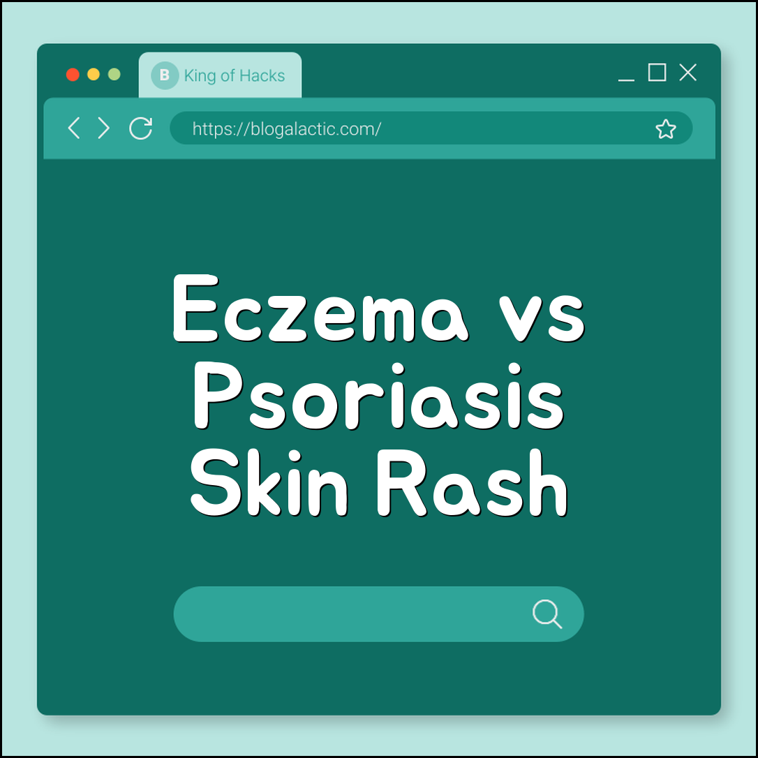Eczema vs. Psoriasis: How to Tell the Difference (skin rash, autoimmune disease, triggers, topical steroids)