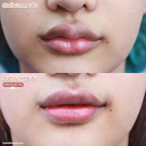 ตกแต่งริมฝีปาก