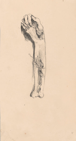 Hand and Arm