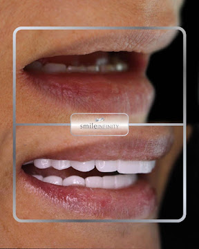 Smile Infinity VIP package Beirut — Dr. Habib Zarifeh CMC Hospital Johns Hopkins