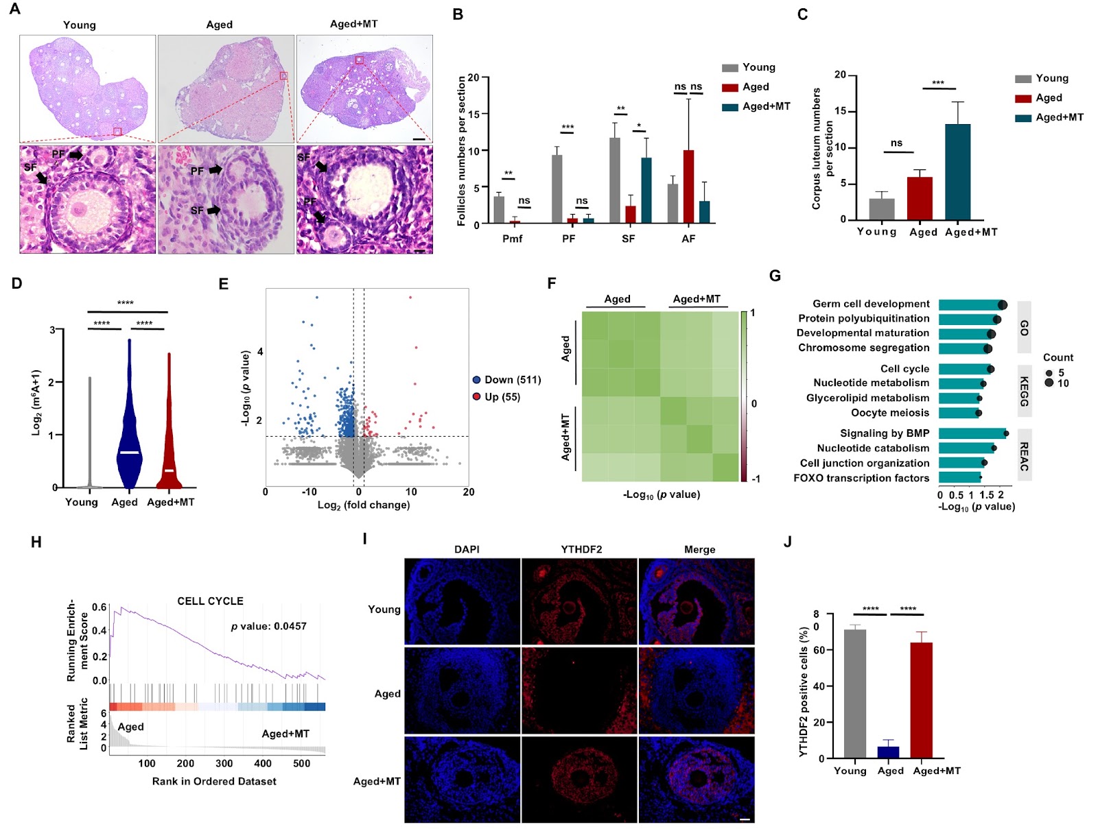 Melatonin mitigates ovarian aging through regulation of the YTHDF2/m6A/UBE3C axis