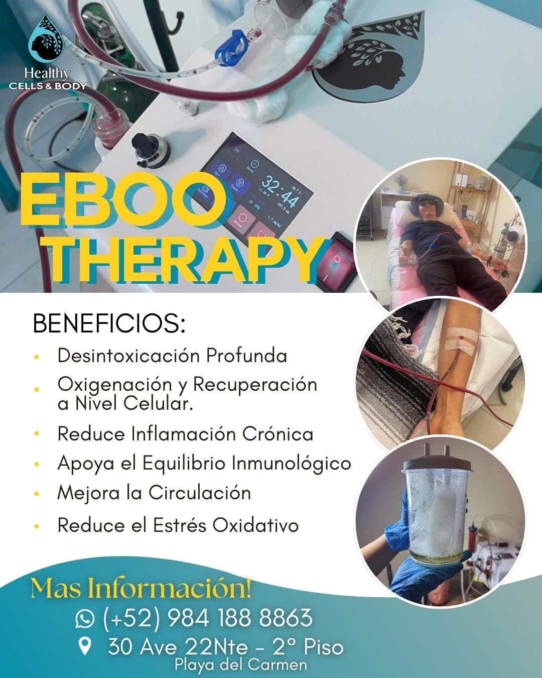 EBOO Therapy