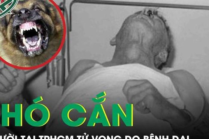 Chó cắn, 3 người tại TPHCM tử vong do bệnh dại - Báo Sức Khỏe &amp; Đời Sống
