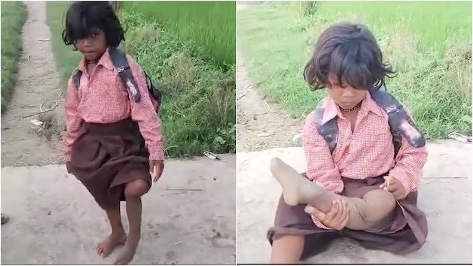 7-Year-Old Ragini’s Brave Hop to School Inspires Nation