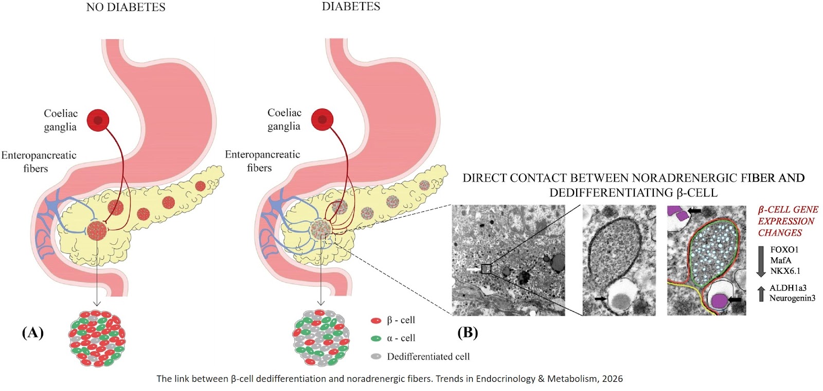 The role of noradrenergic innervation and β-cell dedifferentiation in diabetes