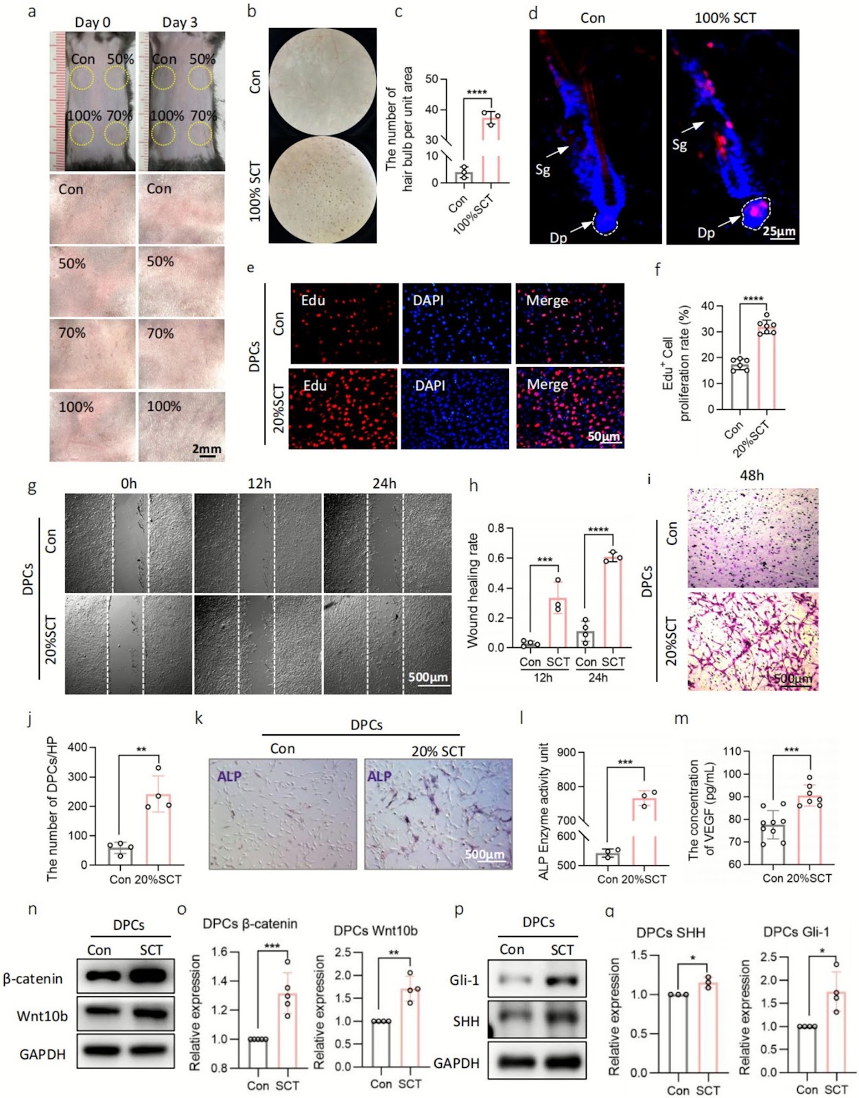 The human umbilical cord–mesenchymal stem cell secretome regulates hair growth and cycle transition by promoting methylthioadenosine synthesis via the PI3K/AKT/mTOR pathway