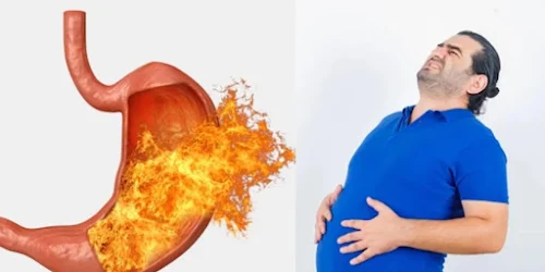 পেটে জ্বালাপোড়া আর অ্যাসিডিটি? জীবনযাত্রা থেকে আজই ছেঁটে ফেলুন এই ৫টি মারাত্মক বদঅভ্যাস