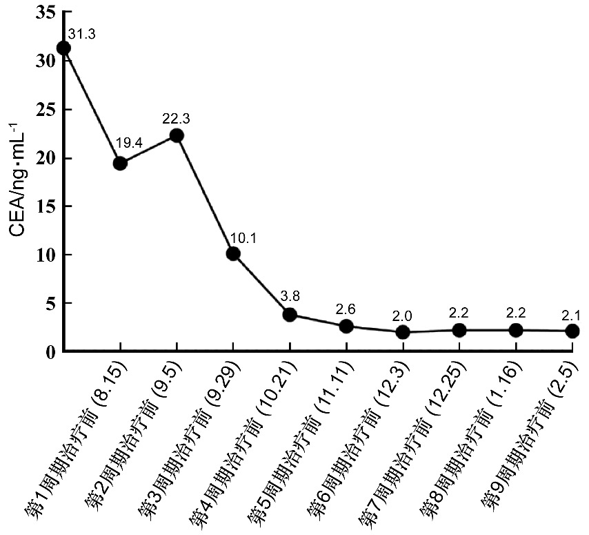 Advanced cholangiocarcinoma therapy: enhanced drug delivery via targeted nanocarriers