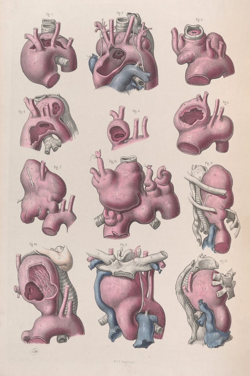 Surgical anatomy Pl16 1856
