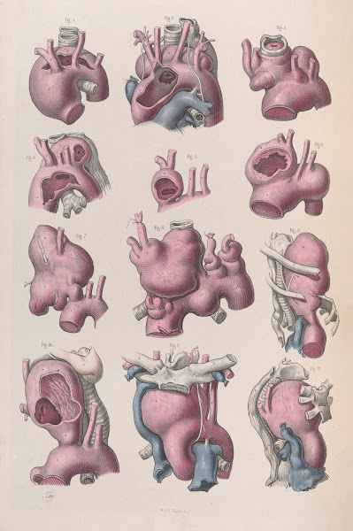 Surgical anatomy Pl16 1856