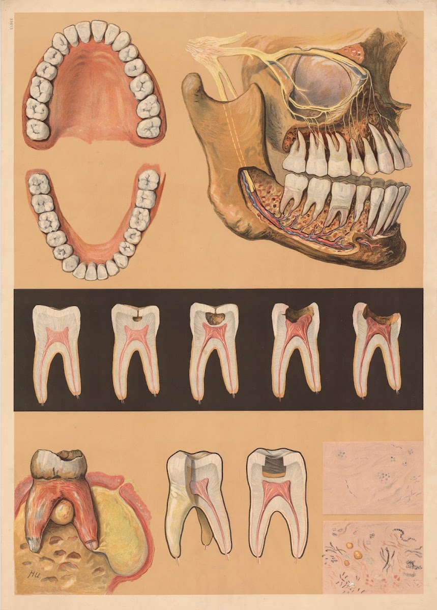 Meinholds dental chart 1912