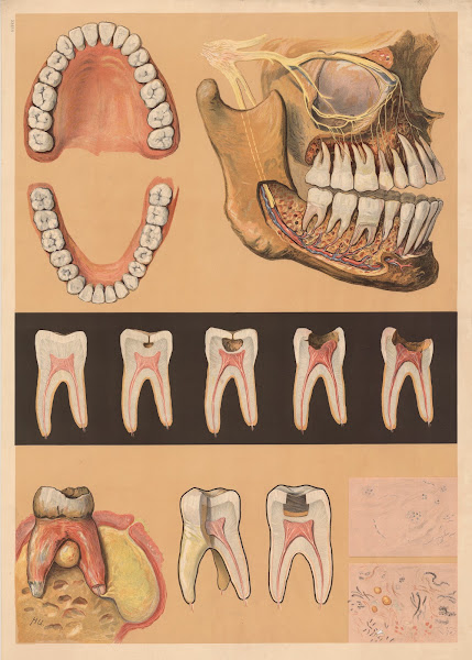 Meinholds dental chart 1912