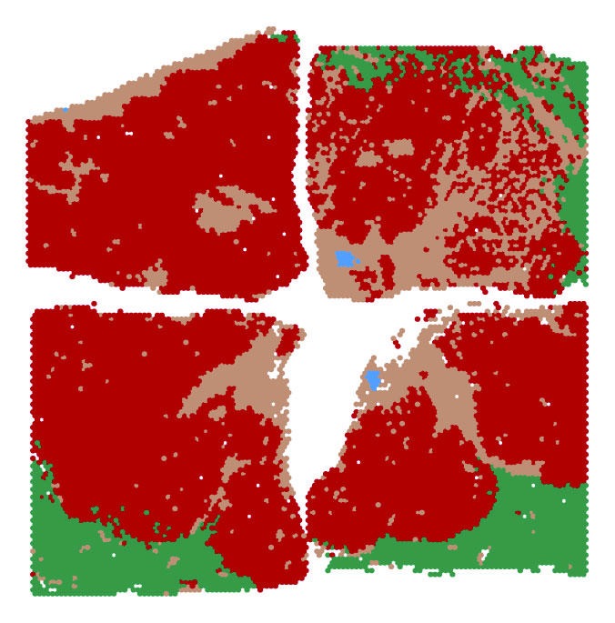 HCCDB v2.0: Decompose Expression Variations by Single-cell RNA-seq and Spatial Transcriptomics in HCC