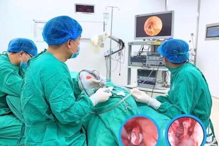 Cholesteatoma bẩm sinh đe dọa sức nghe, tính mạng trẻ - Báo Tri thức &amp; Cuộc sống