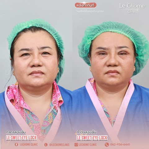 ตา 2 ชั้น