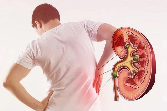 5 dấu hiệu trên cơ thể cảnh báo thận suy yếu âm thầm - Báo Tri thức &amp; Cuộc sống