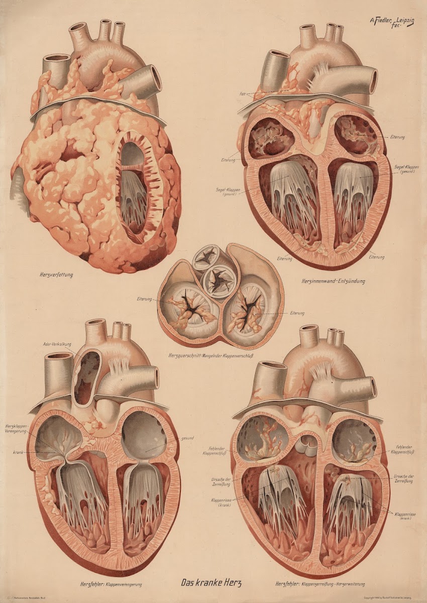 Sick heart 1916