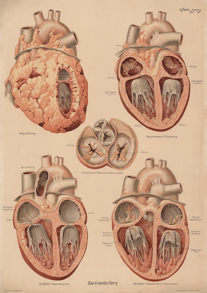 Sick heart 1916